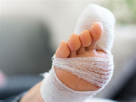 stubbed toe injury